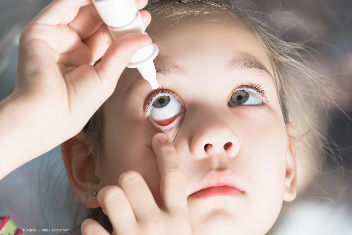 A child putting eye drops into her eye. (Image Credit: AdobeStock/Evgenii)