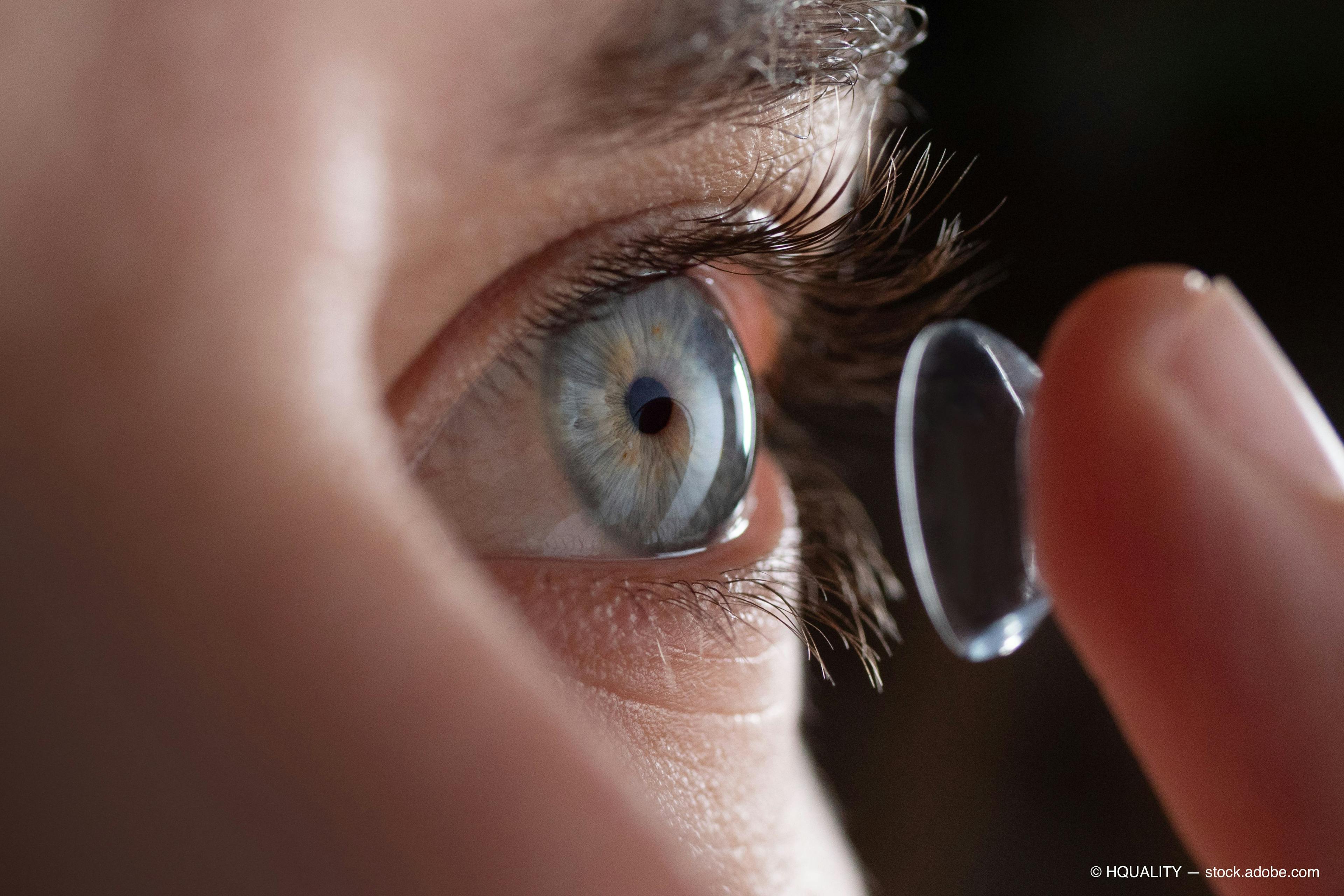 artificial tears offer path to contact lens comfort