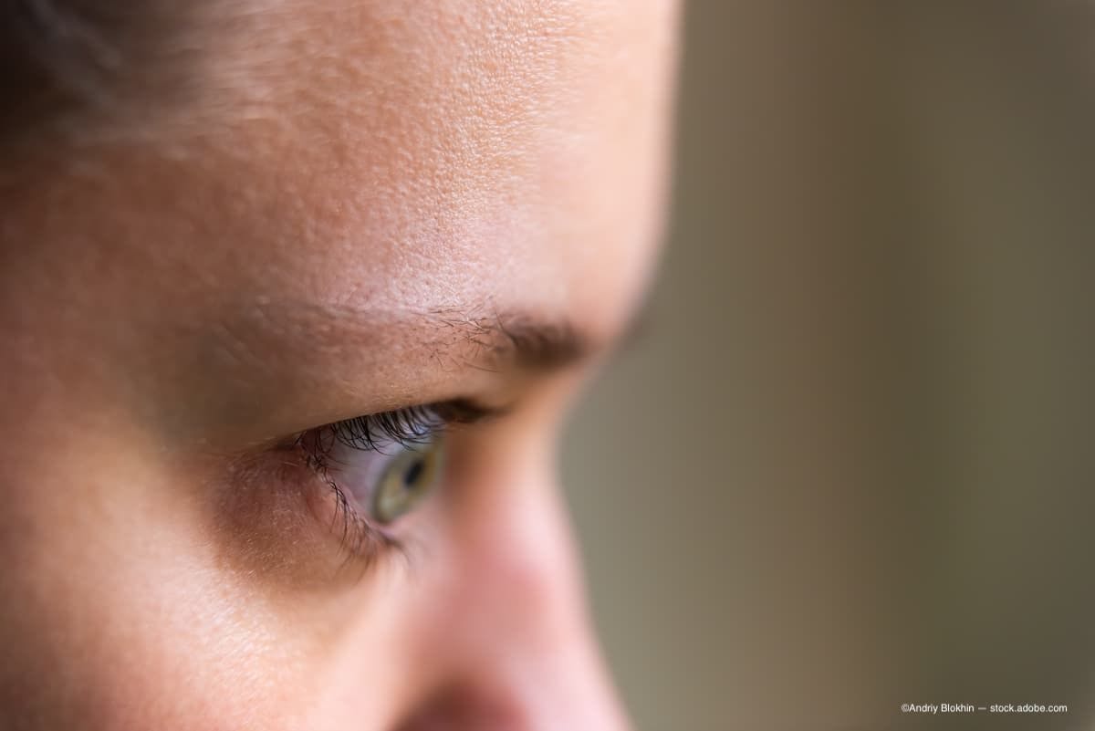 an image of a woman with graves disease. (Image Credit: AdobeStock/Andriy Blokhin)