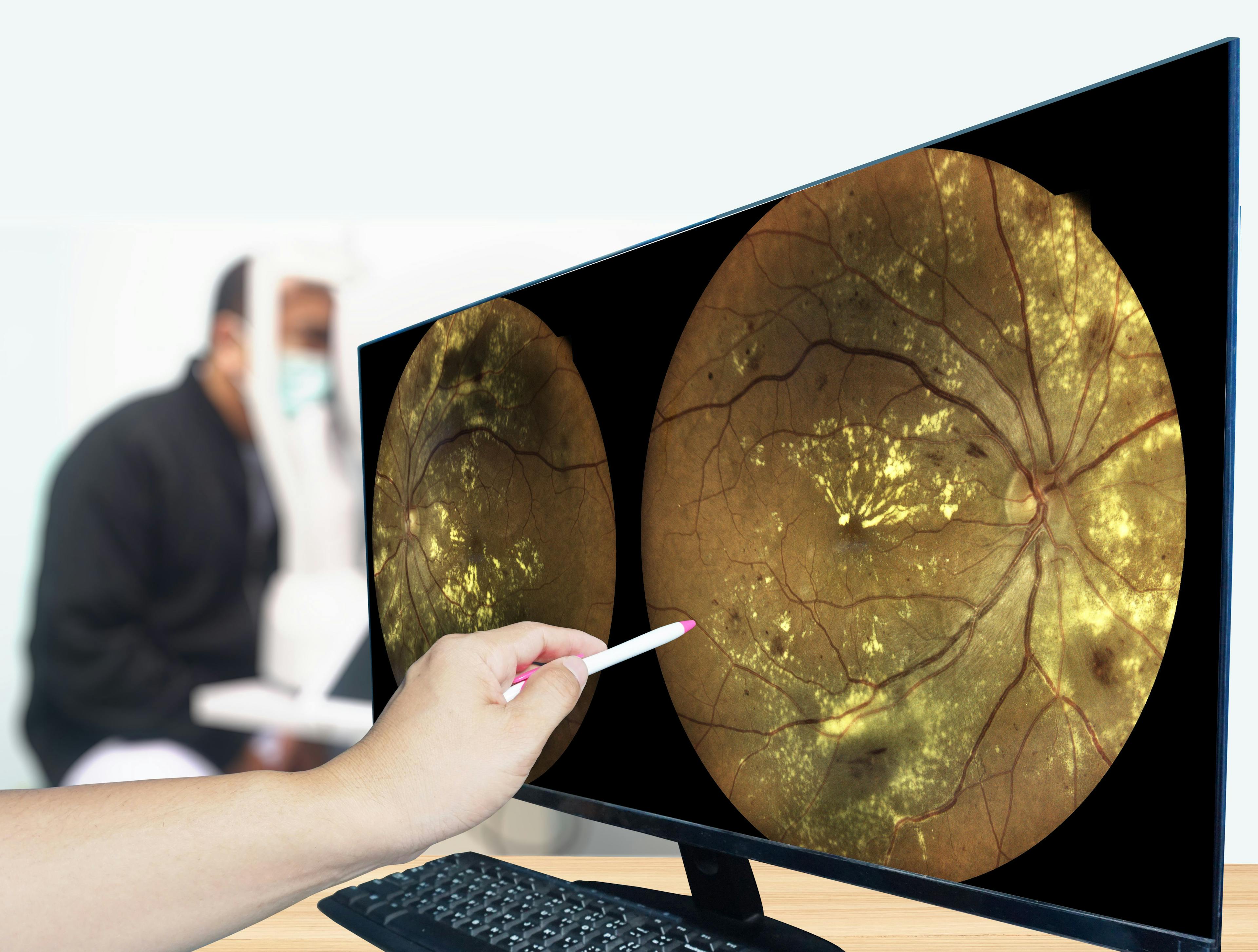 The CLAiR technology is designed to integrate readily with existing retinal imaging cameras, to provide real-time CVD risk assessments with accuracy comparable to traditional cardiovascular risk assessment tools. (Image courtesy of Adobe Stock)