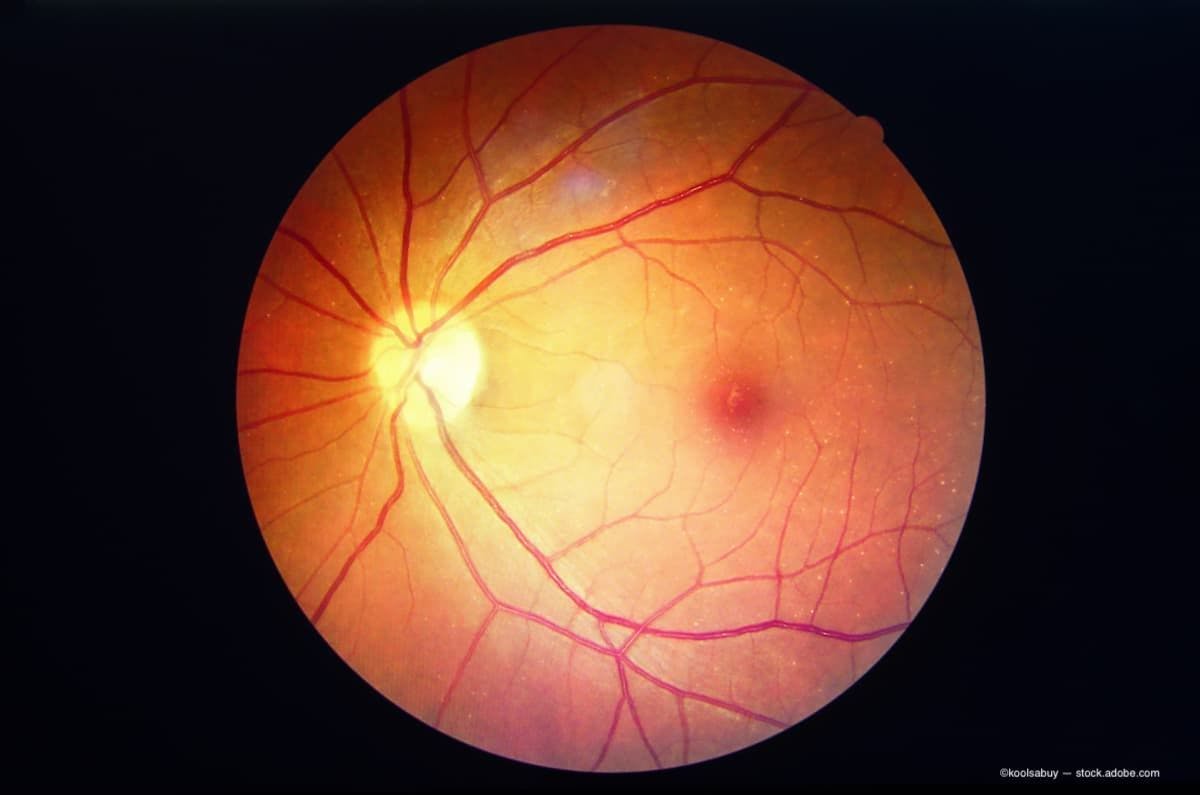 A scan of the retina. (Image Credit: AdobeStock/koolsabuy)