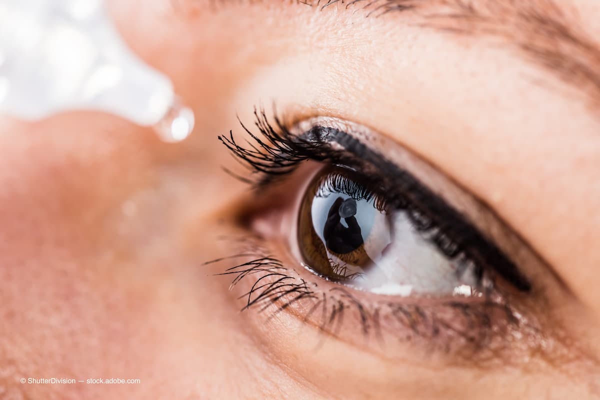 Combination eye drop manages inflammation and infection after cataract surgery