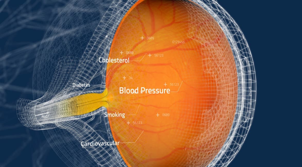 The AI-powered technology identifies elevated cardiovascular risk by analyzing minute changes in the retina and its vasculature (Image courtesy of Toku Inc)