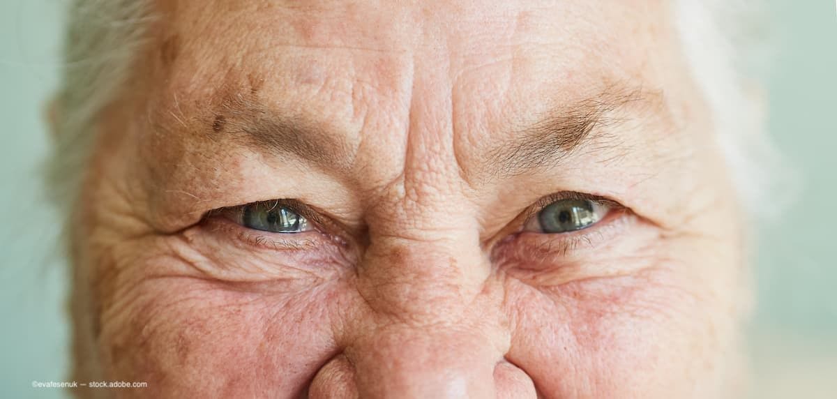 A close image of an older woman's eyes (Image Credit: AdobeStock/evafesenuk)