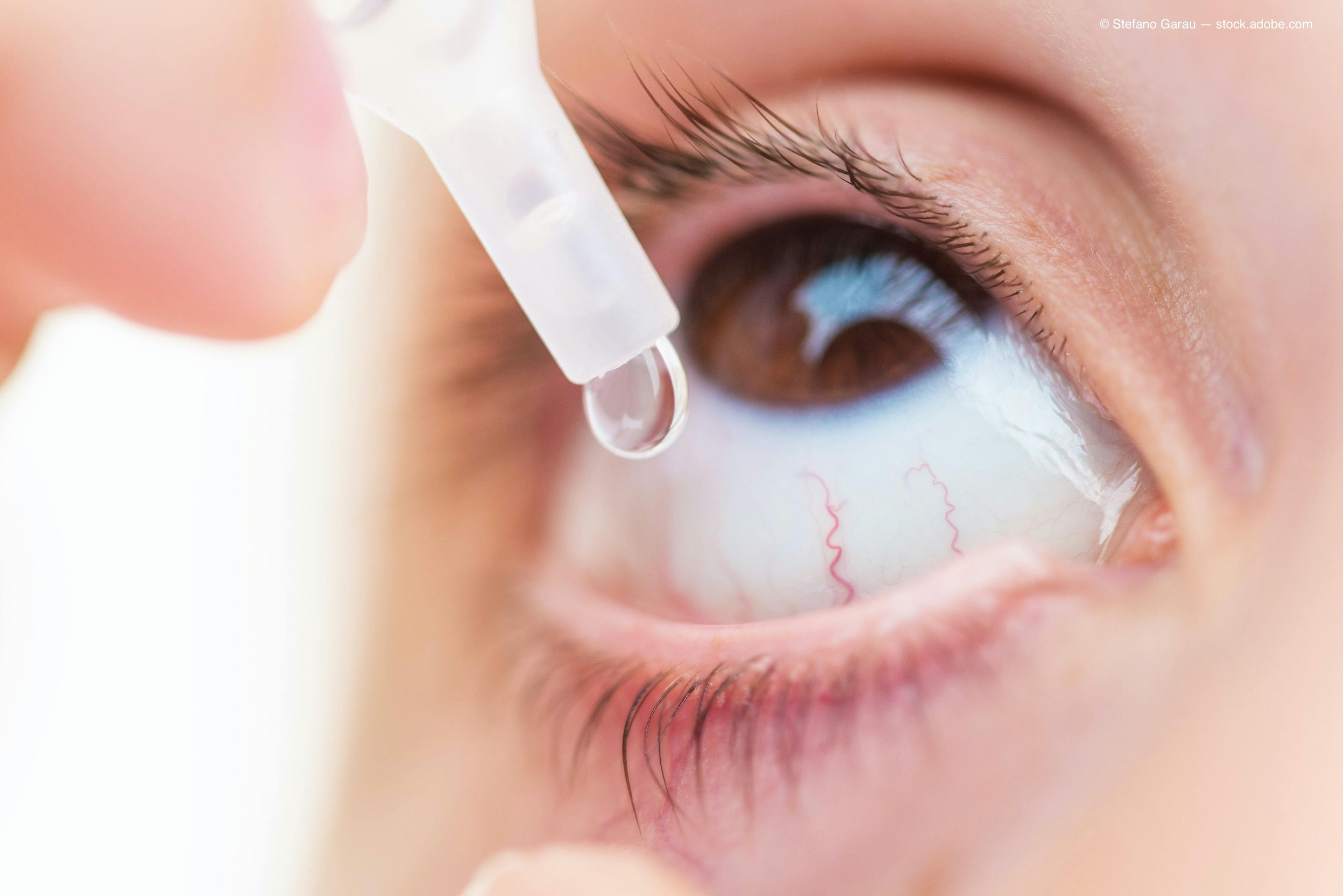 Visus Therapeutics secures FDA acceptance of IND for presbyopia-correcting eye drop