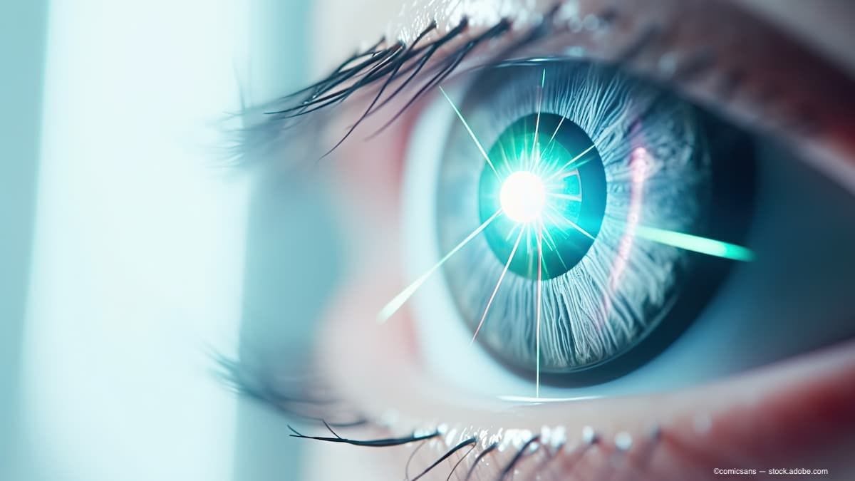 an AI image of an eye with laser corrective surgery. (Image Credit: AdobeStock/comicsans)