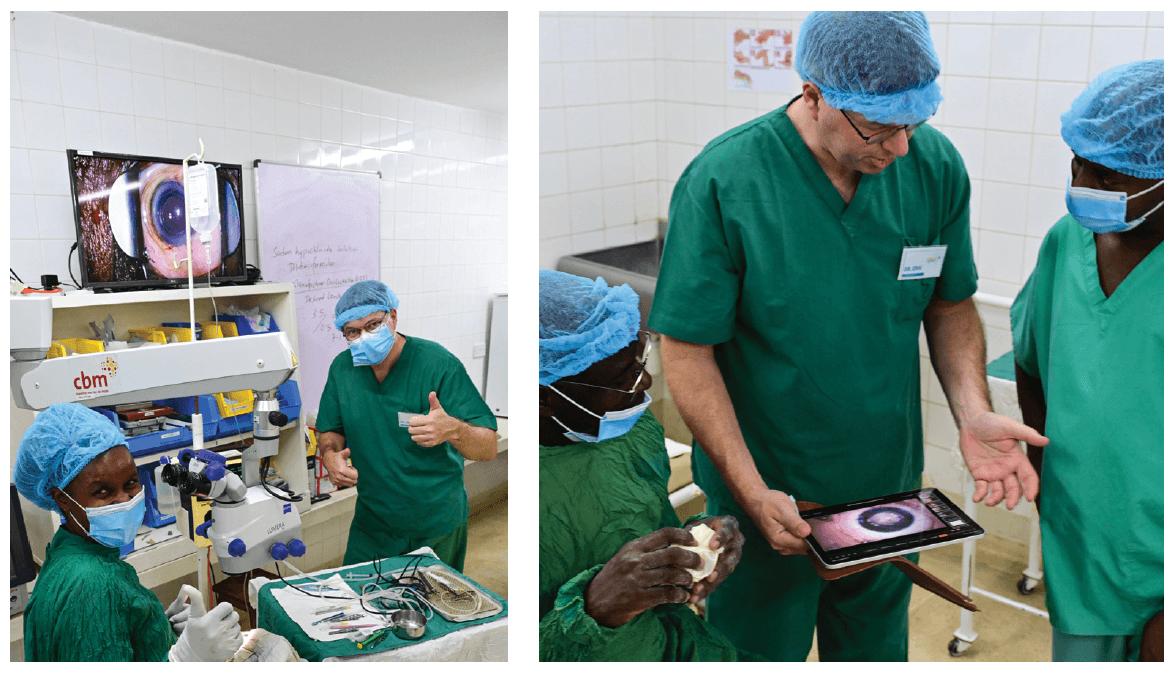 Surgeons train on bag-in-lens procedure in Kwale Eye Centre; a pediatric patient in the operating room. (Images courtesy Alexander S Thrane, MD, PhD, FEBOphth)