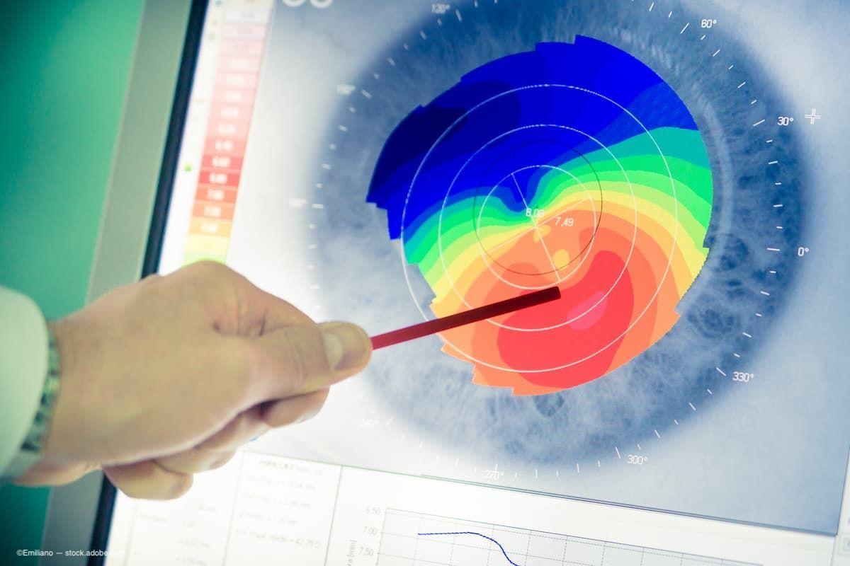 Transforming the eye with a new standard for corneal cross-linking