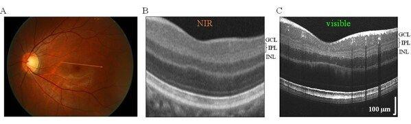 Commercial near-infrared (NIR), center, and visible light Optical Coherence Tomography (OCT) of the same eye. Compared to commercial NIR OCT, visible light OCT achieves fivefold finer axial resolution, which improves visualization of the ganglion cell layer, inner plexiform layer, and inner nuclear layer. (Image credit: NYU Langone)