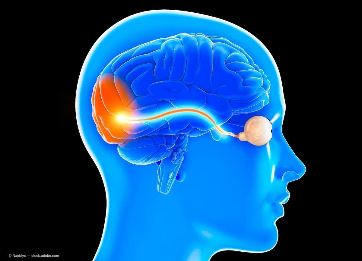 What ophthalmologists need to know about neuromyelitis optica spectrum disorder