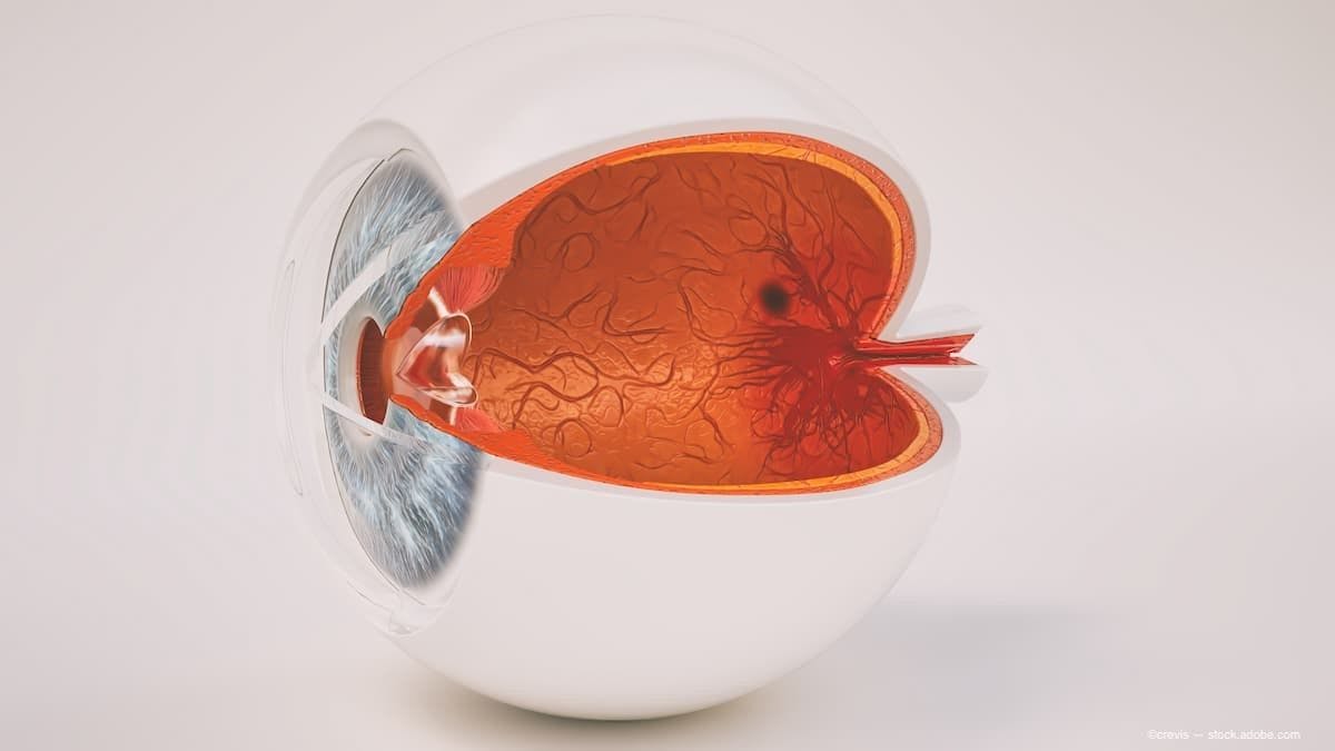 Ophthalmologists highlight treatment options for retinal vascular diseases
