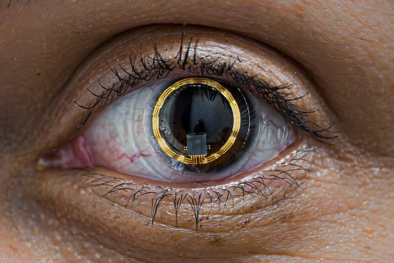 University of Colorado of Medicine professors sent Triggerfish “smart” contact lenses to monitor changes to astronauts’ eyes during the SpaceX Polaris Dawn mission. (Image credit: John Krais/Polaris program)