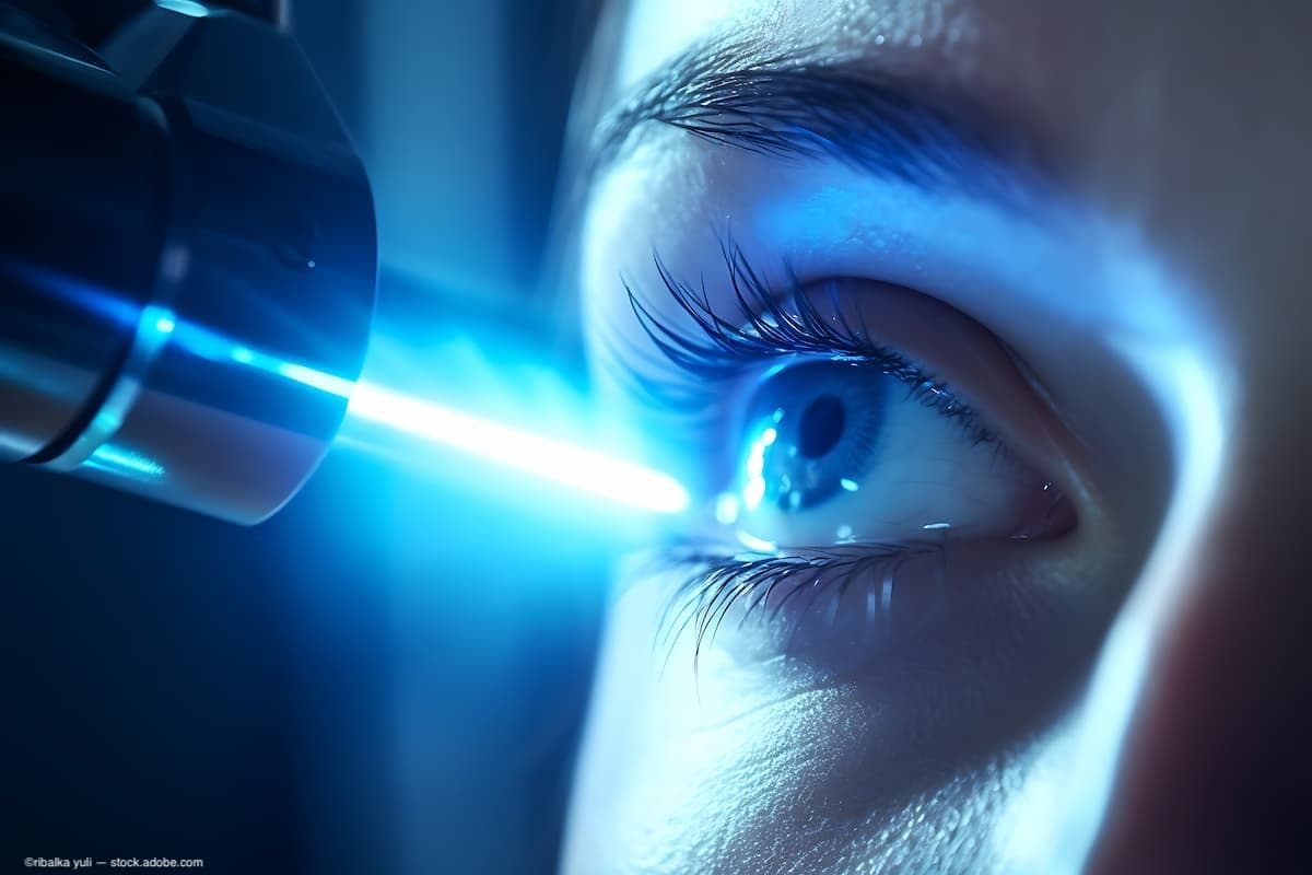 A history of the femtosecond laser in the United States and Europe