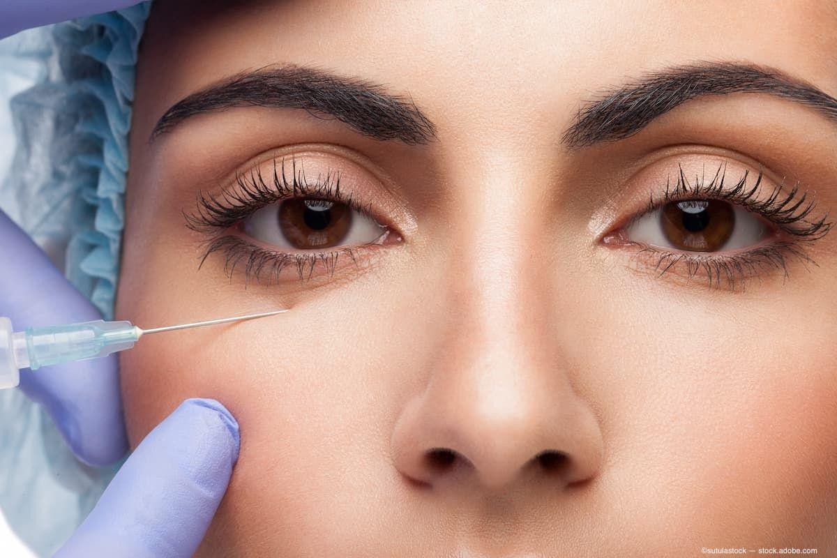 Blog: Intervention may be necessary when too much filler is used under the eye 