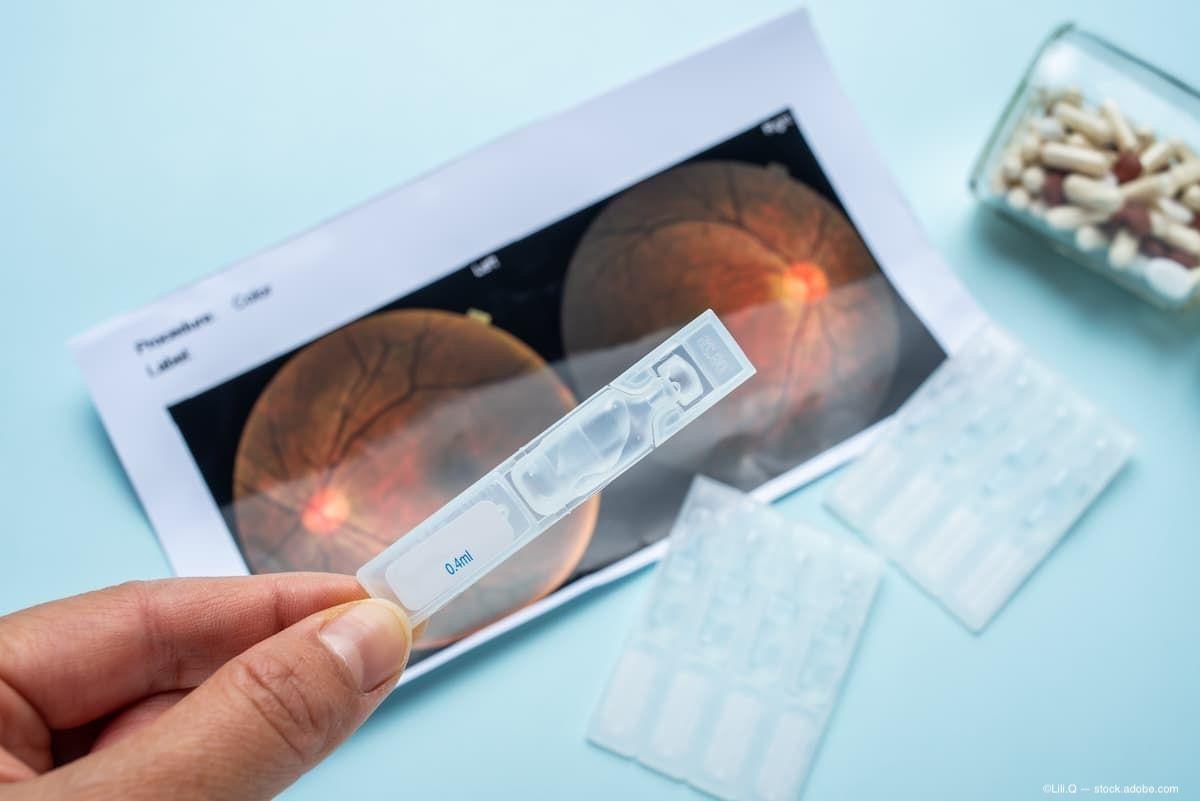 Stealth BioTherapeutics presents preclinical data on bevemipretide's retinal delivery in AMD models