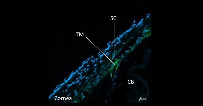 The research team has investigated the mechanisms of miR-17-92 cluster on intraocular pressure and performed immunostaining on TSP-1. (Image credit: Research and Innovation Office, The Hong Kong Polytechnic University)