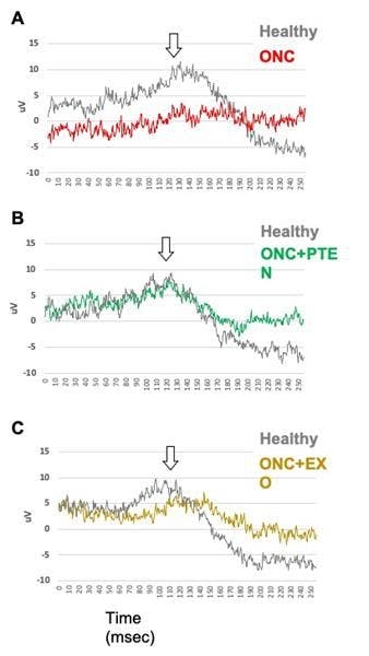 Graphs A-C show Electroretinogram (ERG) measurements of dark-adapted (scotopic) threshold retinal response (STR, in microvolts, mV) at -36 dB of three representative rats. (Image credit: NurExone Biologic Inc.)