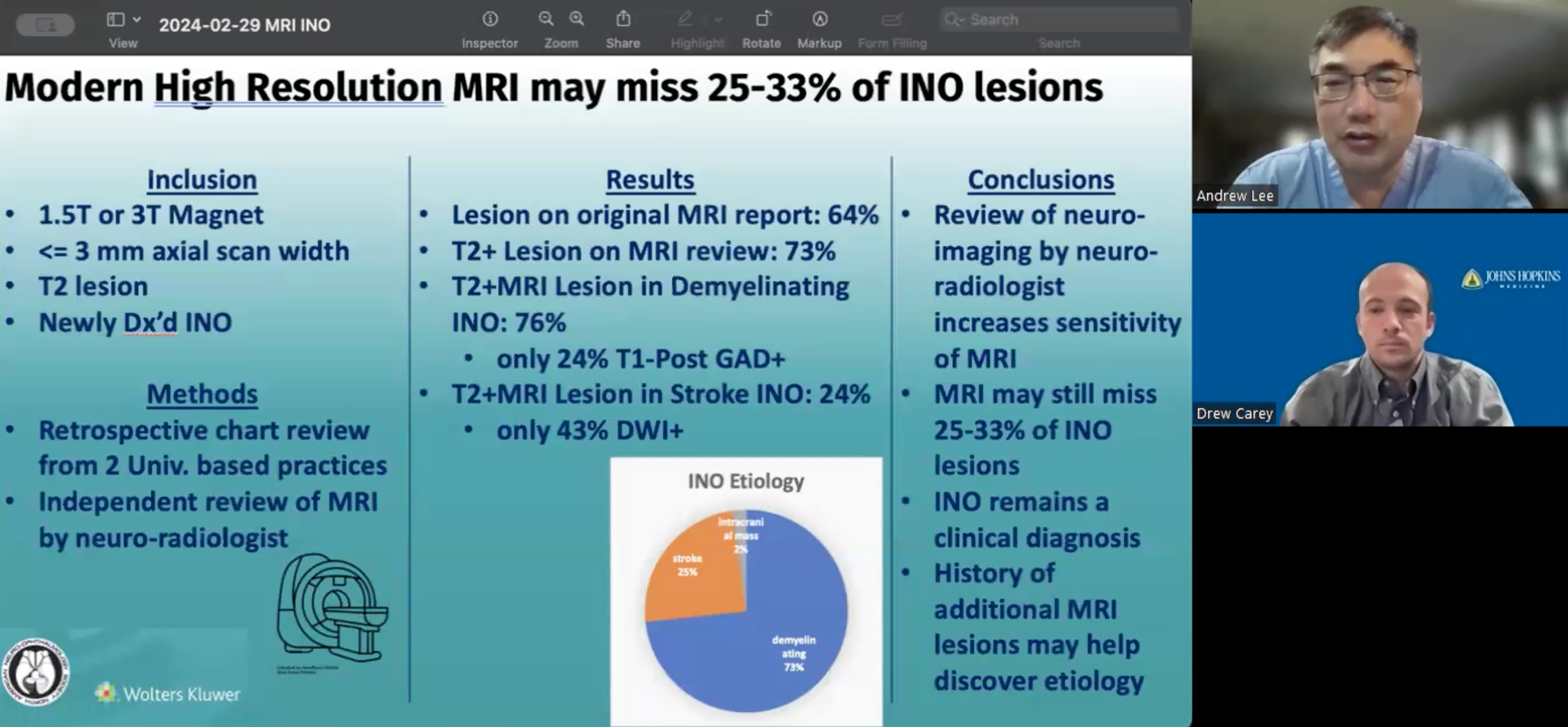 VLOG: NeuroOp Guru: High-resolution MRI may miss a third of INO lesions